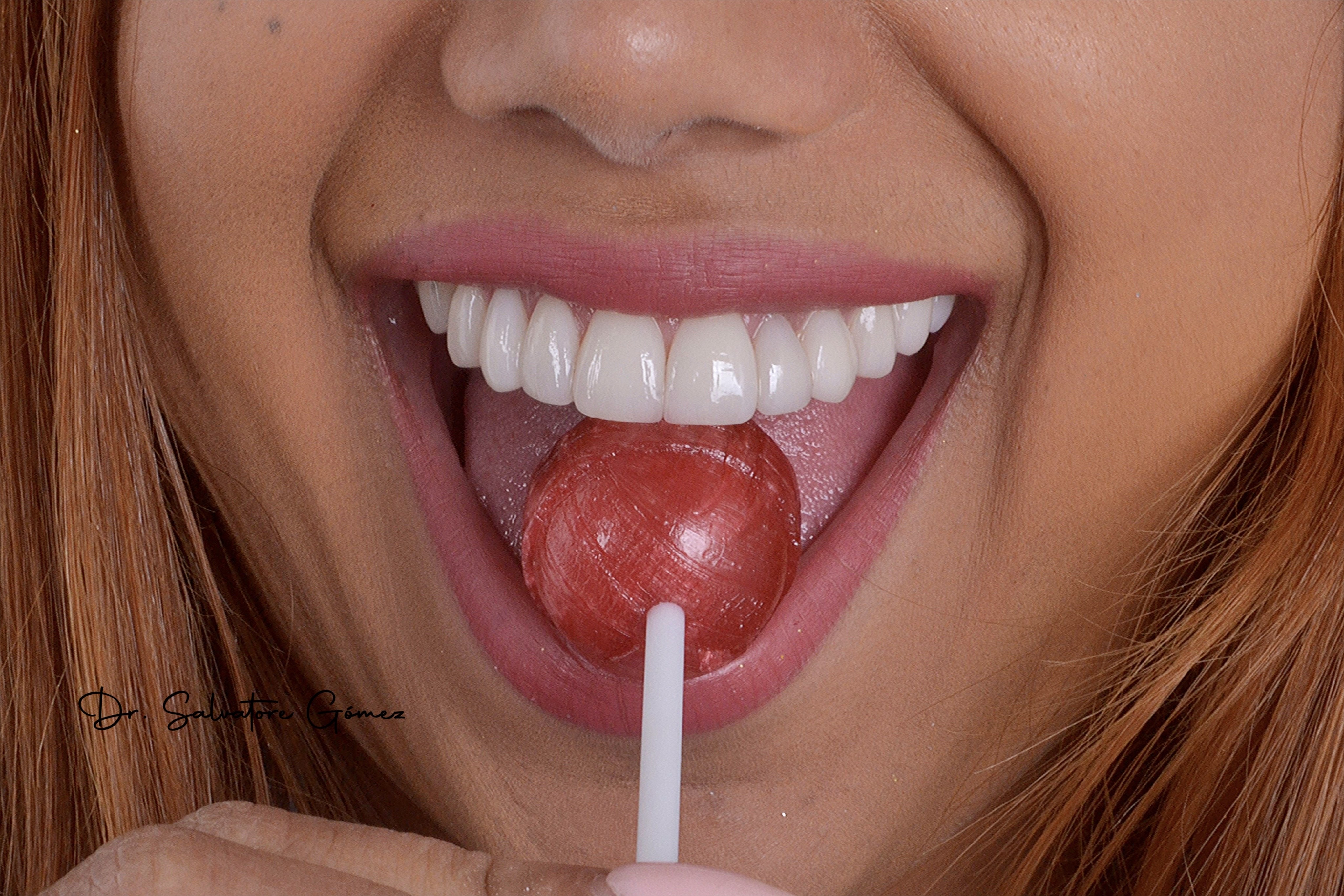 Clínica dental de lujo en Miami
